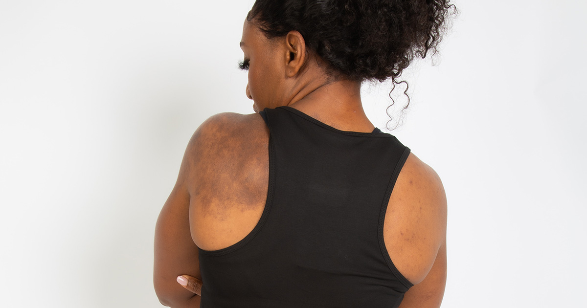 Why Are You Not Losing Weight on Zepbound? Possible Causes | Ro