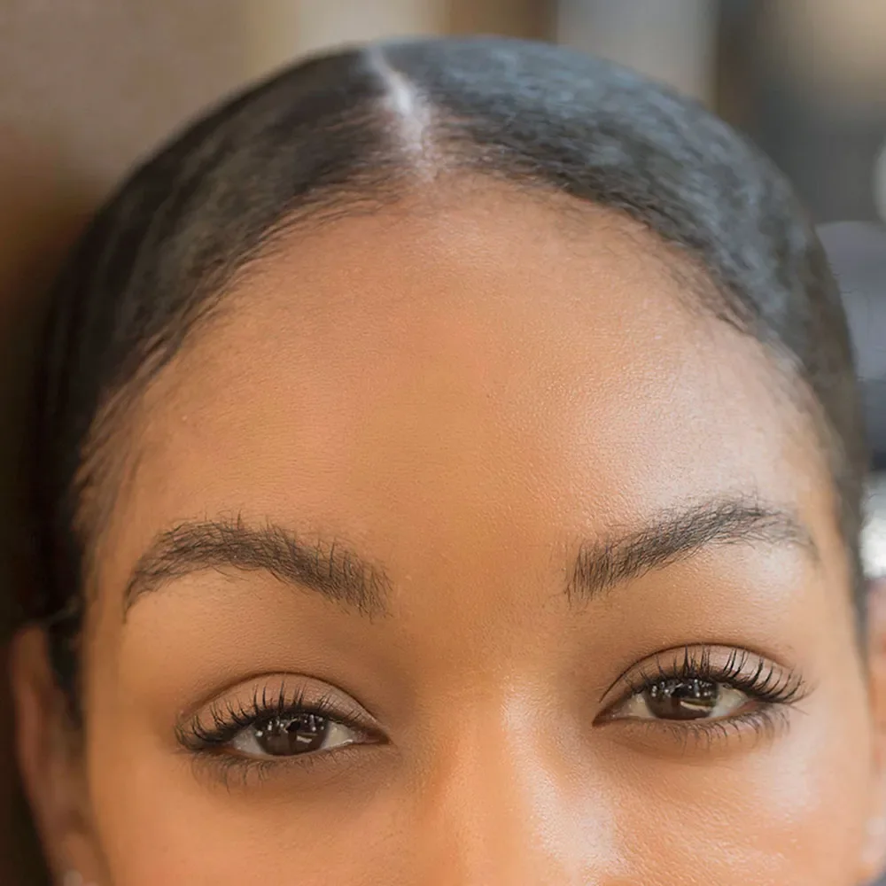 How to get rid of forehead wrinkles - Desktop Image