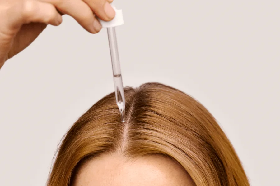 Hair Loss Statistics