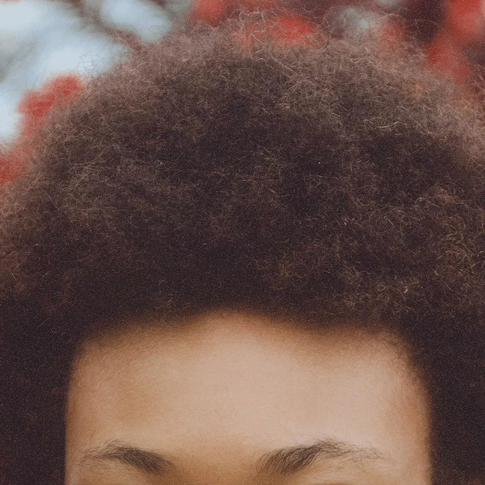 How to get rid of dandruff: tips, remedies, and treatments - Desktop Image