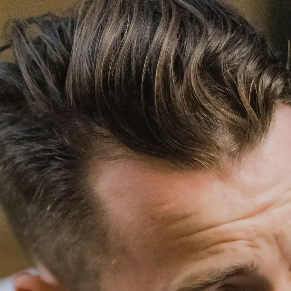 semaglutide itchy scalp Itchy Scalp and Hair Loss: Are They Connected?