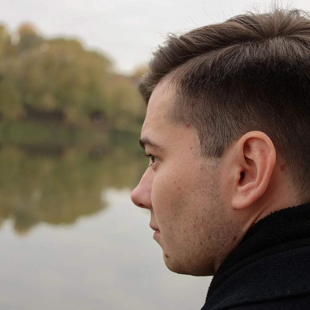 Preventing and treating hair loss on Accutane (isotretinoin) - Desktop Image