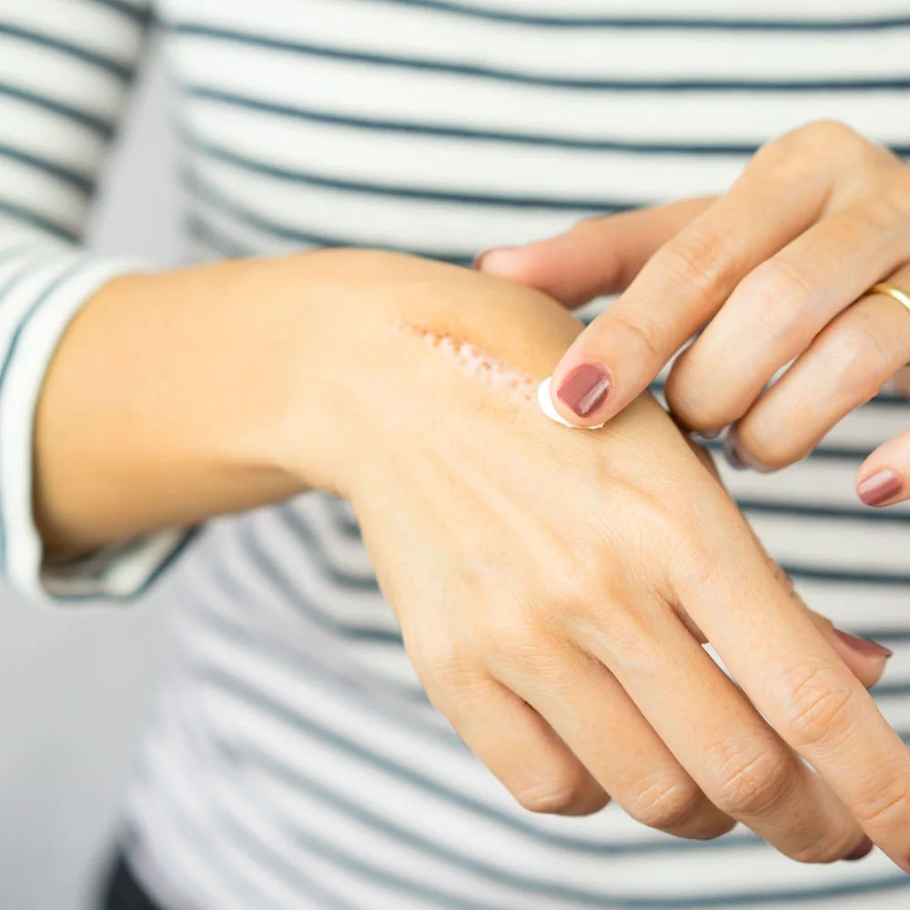 3 benefits of vitamin E for skin and how to use it - Desktop Image