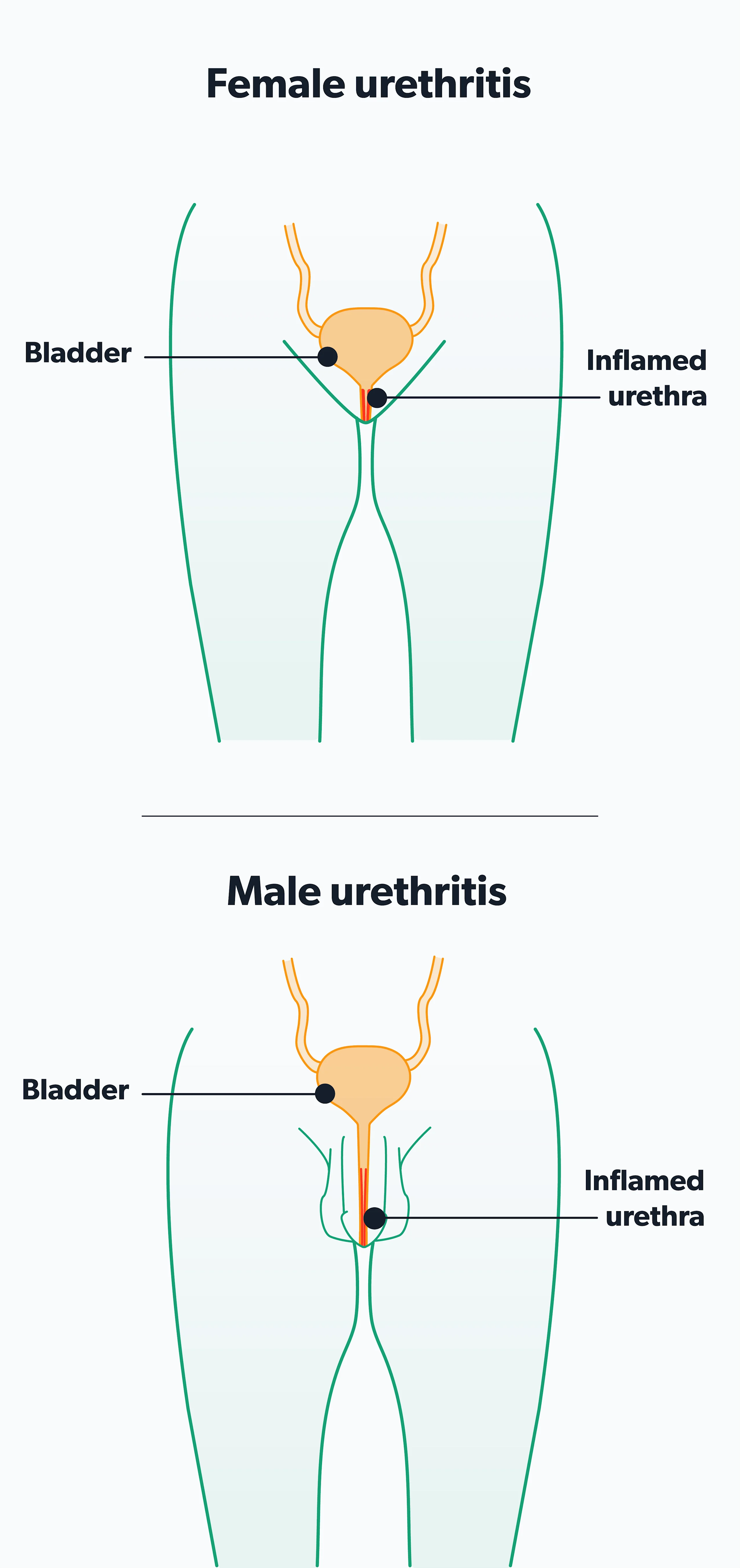 Chlamydia: Symptoms, Diagnosis, Risk Factors, Treatment | Ro