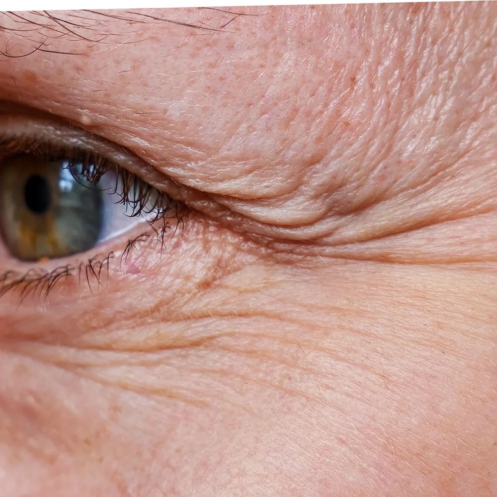 How to get rid of wrinkles: 12 wrinkle removing options - Desktop Image