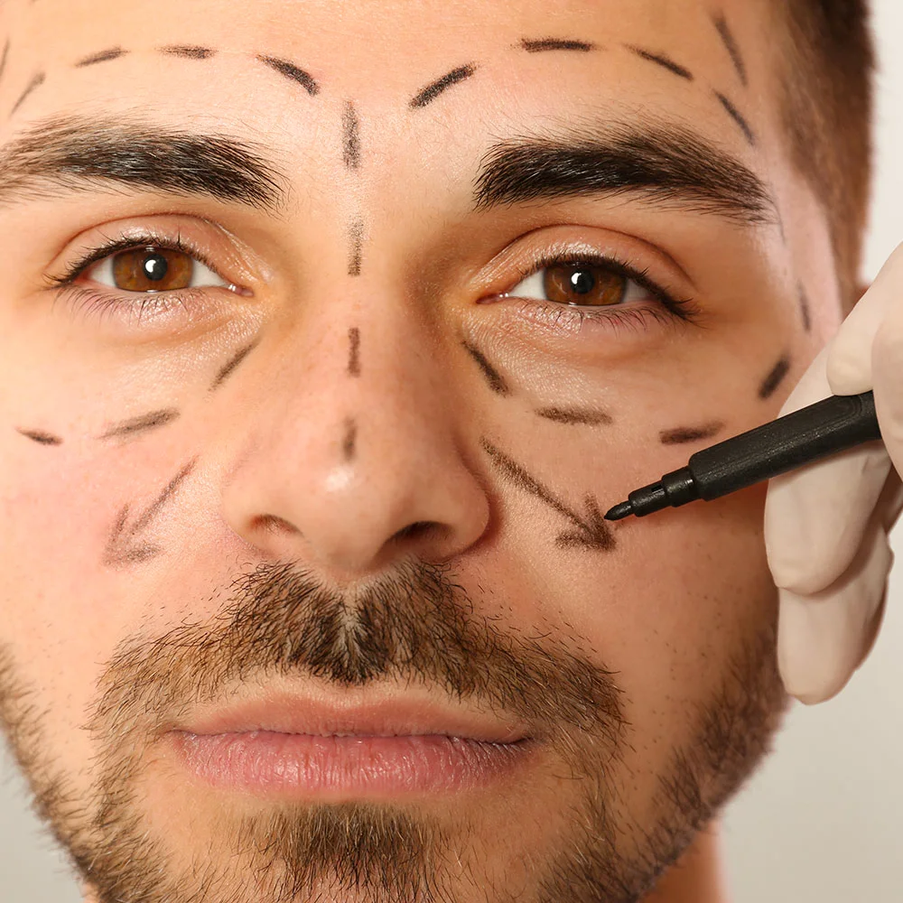 Facelift: what is it, types, cost, recovery - Desktop Image