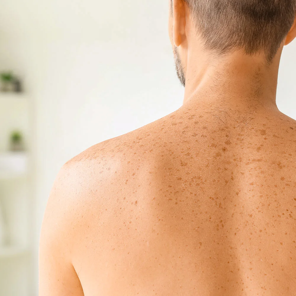 Premature aging: what is it, symptoms, and how to prevent it - Desktop Image