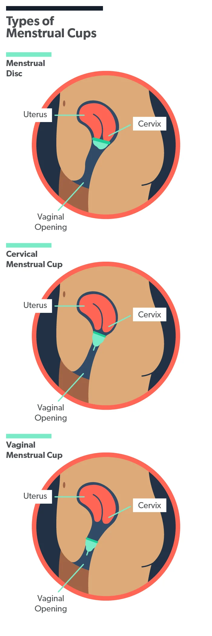OC Sex with a menstrual cup: safety and tips image 58ed6091-35ff-462a-a186-078d3427a998