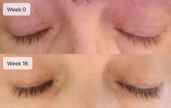 Ro member growing eyelashes after treatment; Week 0: short and thin eyelashes; Week 16: longer and fuller eyelashes