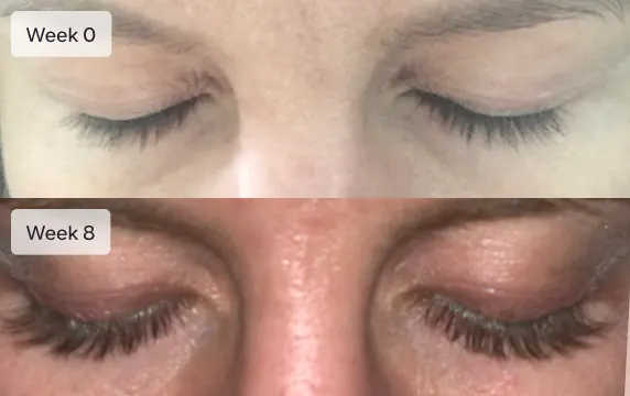 Ro member growing eyelashes after treatment; Week 0: short and thin eyelashes; Week 8: longer and fuller eyelashes