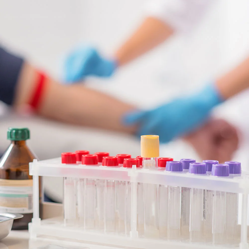 Vitamin D blood test: what the results mean - Desktop Image