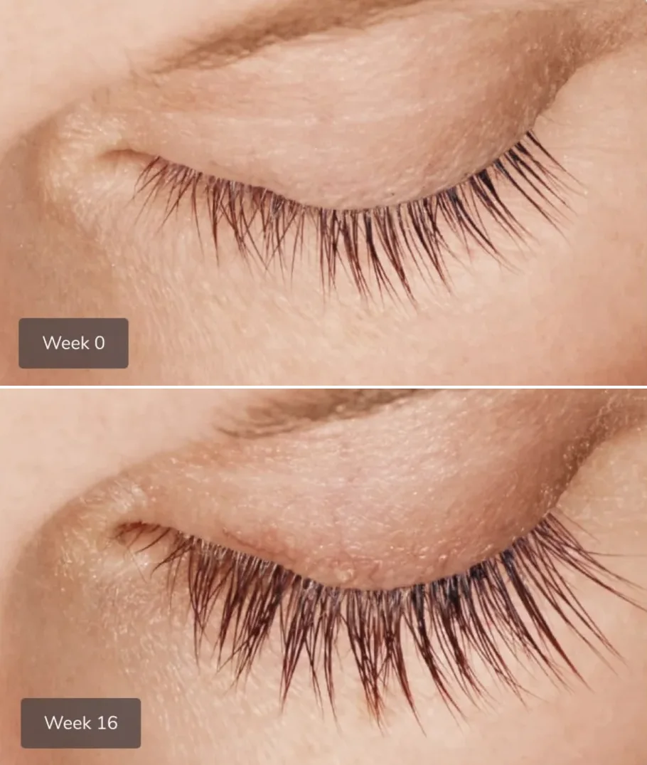 Ro member growing eyelashes after treatment; Week 0: short and thin eyelashes; Week 16: longer and fuller eyelashes