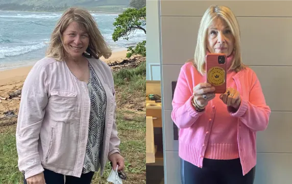 a woman before and after taking GLP-1 medication for weight loss