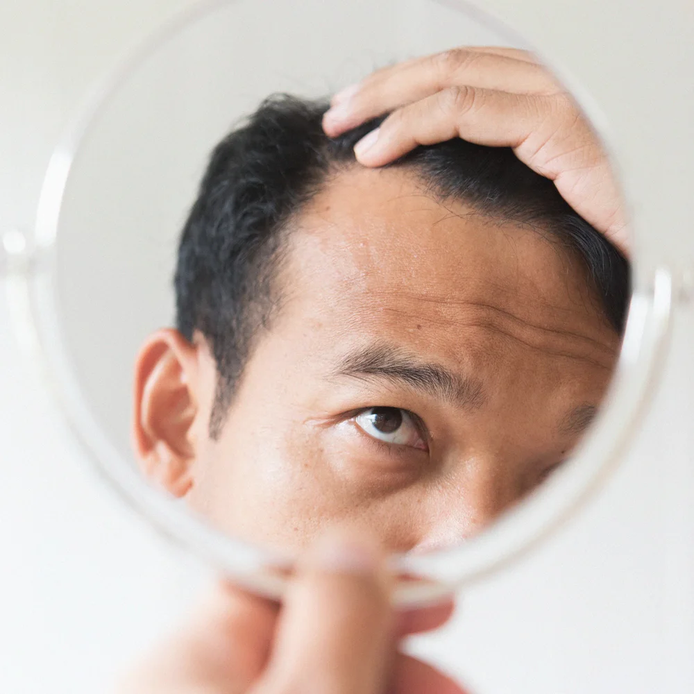 DHT and hair loss: what you need to know - Desktop Image