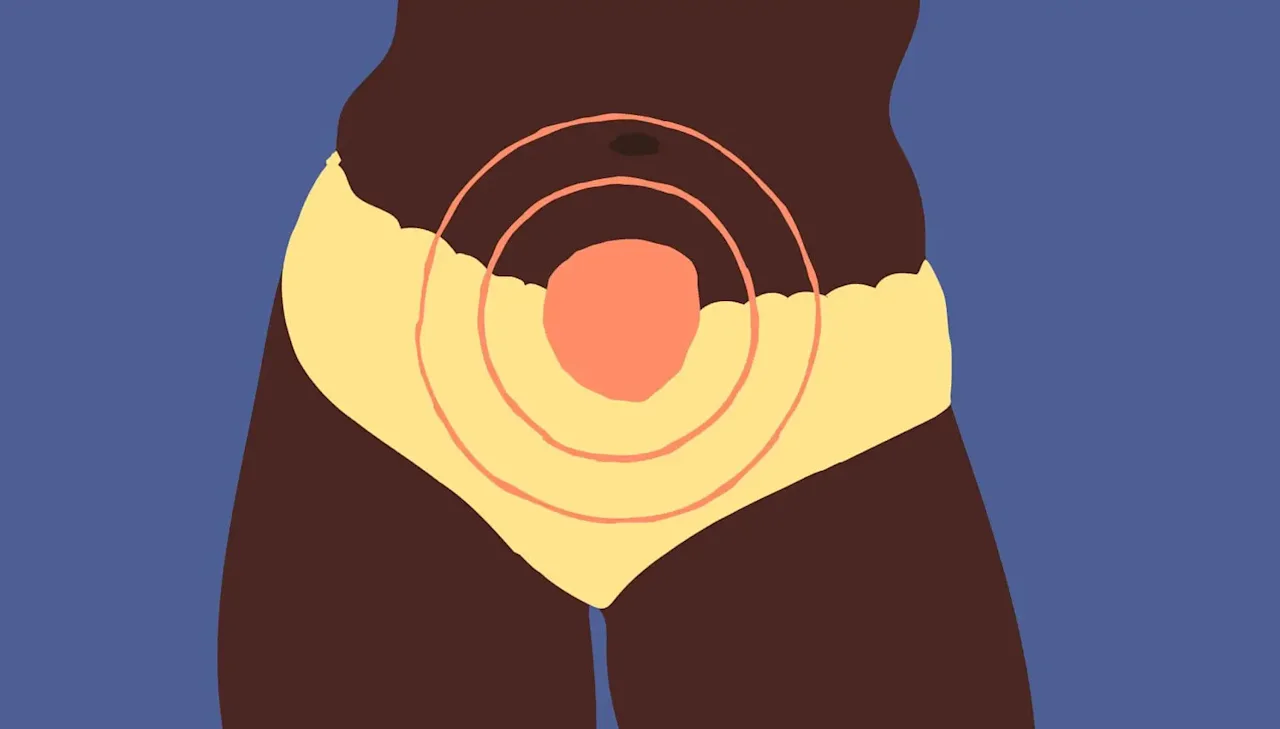 Lightning crotch during pregnancy: what it is and what you can do about it - Desktop Image