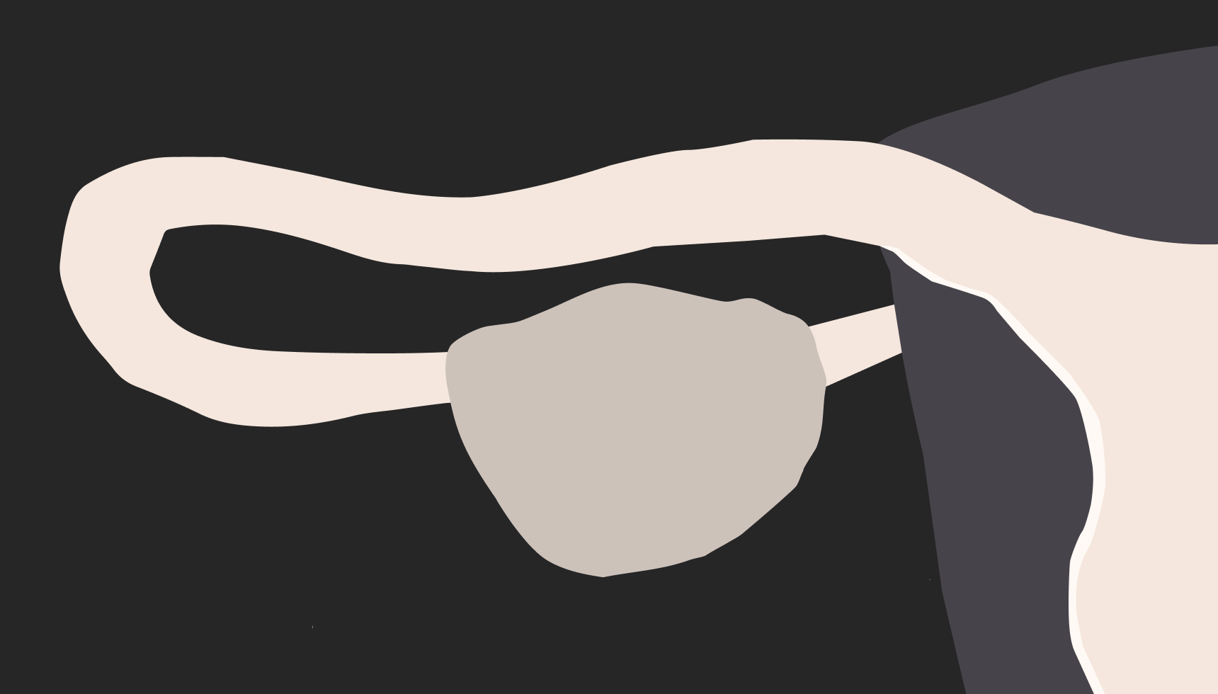 HSG Tests Side Effects, Costs, and What to Expect Ro