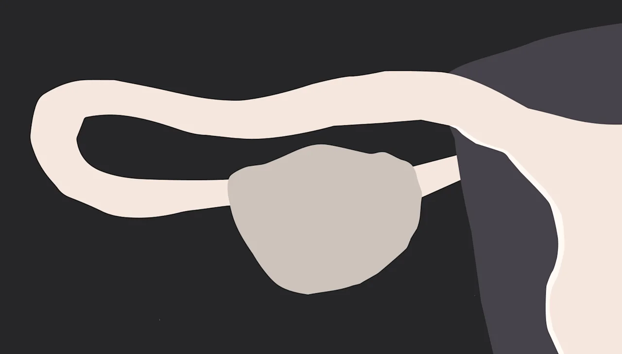 HSG tests: potential side effects, costs, and what to expect - Desktop Image