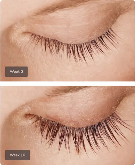 Ro member growing eyelashes after treatment; Week 0: short and thin eyelashes; Week 16: longer and fuller eyelashes