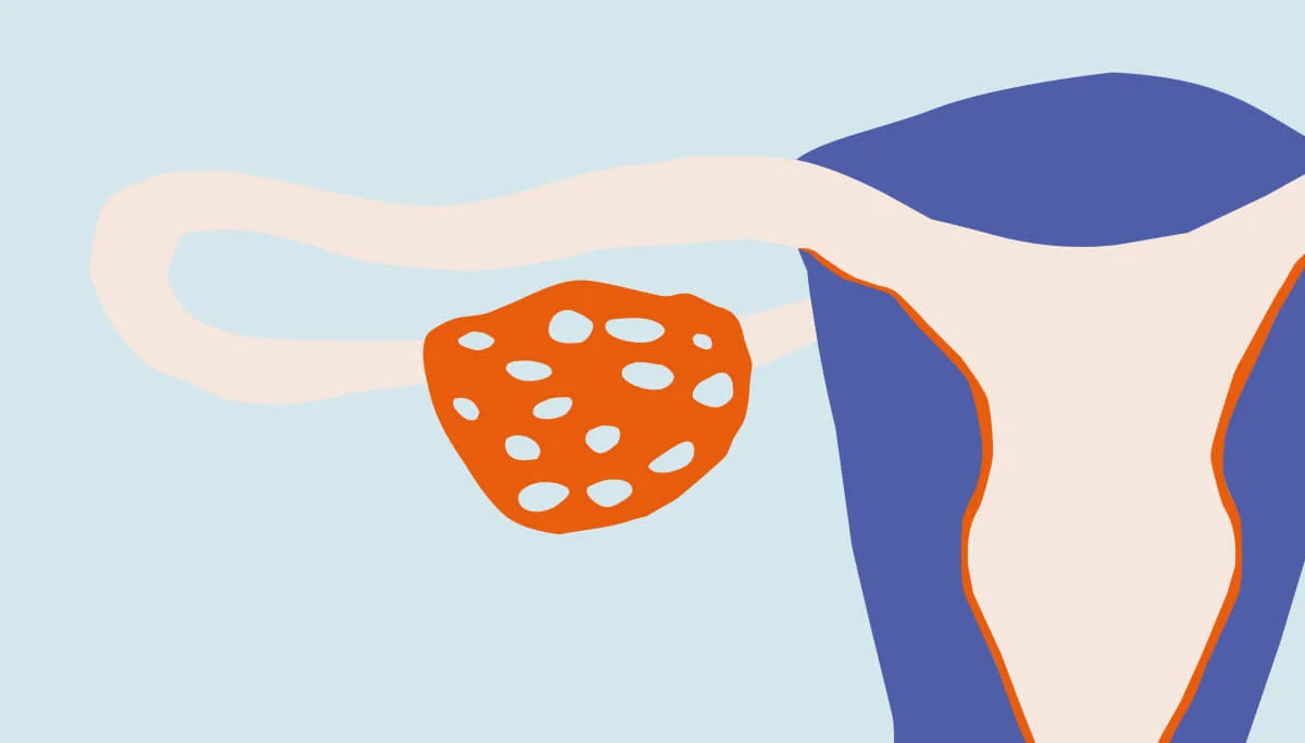 The science behind ovarian reserve testing - Desktop Image