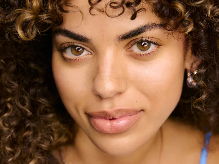 Woman with Upneeq treated eyes