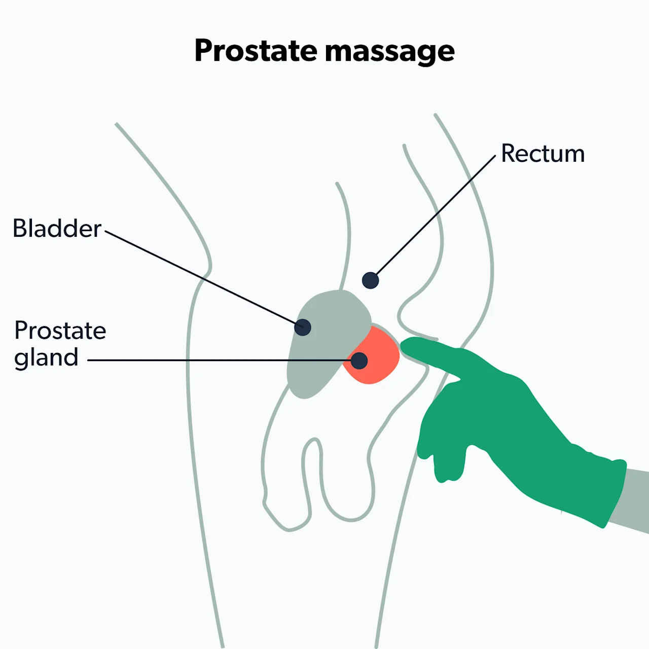 OC Prostate massage: health benefits of hitting the male G-spot image 7f70bf27-9978-487a-830e-e0a8b414df54