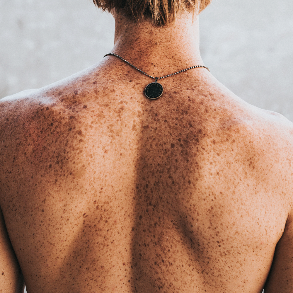 Eczema and tatoos | Eczema Foundation