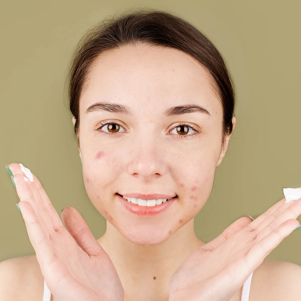 Zinc for acne: benefits, side effects, how to use - Desktop Image
