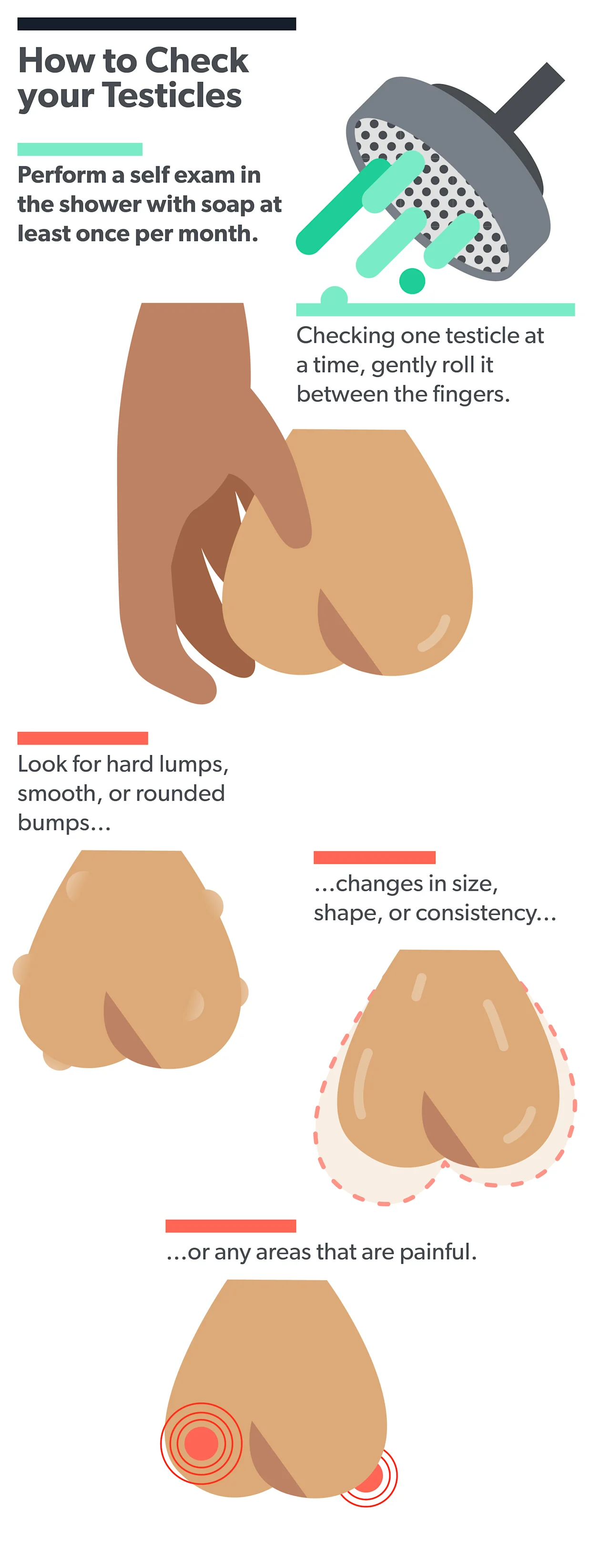 OC Cryptorchidism (undescended testicle): what is it, symptoms, treatment image c8c21625-36bf-4445-a3d3-ad2651ce066d