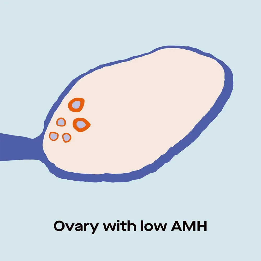 OC AMH levels by age: charts and fertility implications image e5b937dd-3681-45a5-9ad8-452aec944b4e
