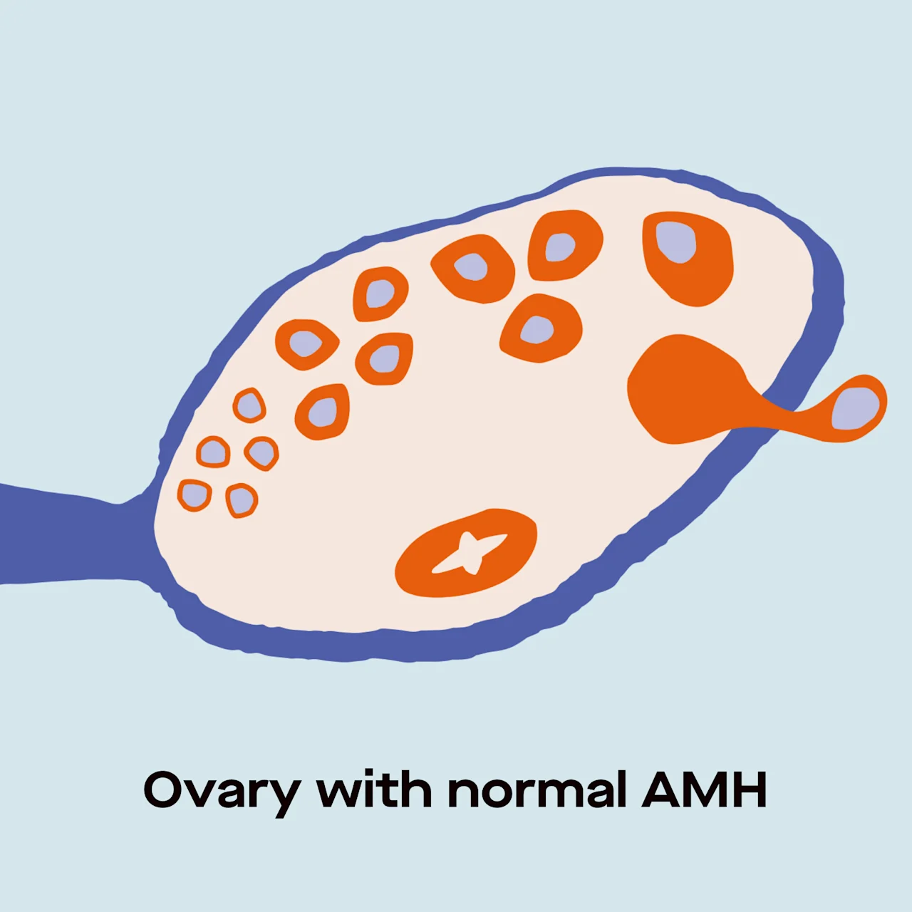 OC AMH levels by age: charts and fertility implications image f60944b2-ef8d-4199-ad60-a3636cd17473